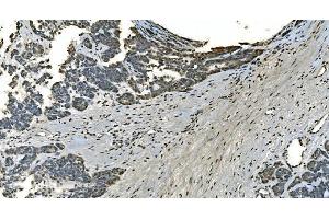 IHC analysis of LSM8 using anti-LSM8 antibody (ABIN7599579). (NAA38 anticorps  (AA 1-96))