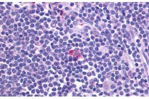 Anti-CXCR5 antibody  ABIN1048479 IHC staining of human spleen.