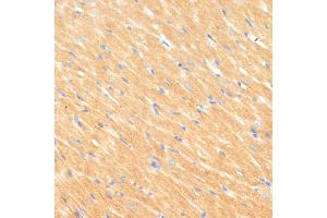 Immunohistochemistry of paraffin-embedded rat heart using MYBPC3 antibody (ABIN6129601, ABIN6144221, ABIN6144222 and ABIN6215951) at dilution of 1:100 (40x lens).