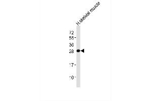 Anti-GSTM2 Antibody at 1:1000 dilution + human skeletal muscle lysates Lysates/proteins at 20 μg per lane. (GSTM2 anticorps)