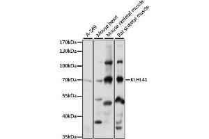 Western blot analysis of extracts of various cell lines, using KLHL41 antibody (ABIN7268084) at 1:1000 dilution. (Kelch-like protein 41 (KLHL41) (AA 1-300) anticorps)