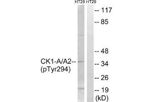 Western blot analysis of extracts from HT-29 cells treated with heat shock using CK-1α (Phospho-Tyr294) Antibody. (CSNK1A1 anticorps  (pTyr294))
