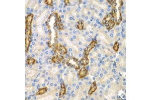 Immunohistochemistry of paraffin-embedded mouse kidney using CNPY3 antibody at dilution of 1:100 (x400 lens). (TNRC5 anticorps)