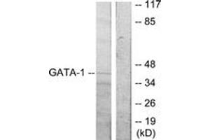 Western blot analysis of extracts from COS7 cells, using GATA1 (Ab-310) Antibody. (GATA1 anticorps  (AA 277-326))