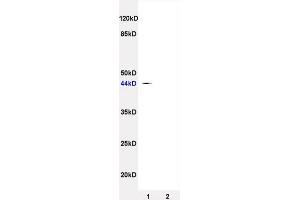 L1 rat brain lysates, L2 rat heart lysates probed (ABIN738351) Anti-SynCAM/TSLC1 Polyclonal, Unconjugated at 1:200 in 4 °C.
