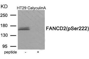 Western blot analysis of extracts from HT29 cells treated with CalyculinA using Phospho-FANCD2 (Ser222) antibody. (FANCD2 anticorps  (pSer222))