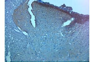 IHC on paraffin sections of rat spinal cord tissue using Rabbit antibody to pro BDNF (50-90): . (Pro BDNF anticorps)