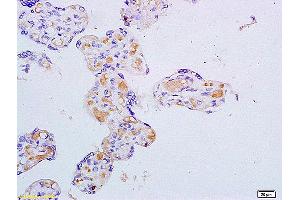 Formalin-fixed and paraffin embedded mouse intestine labeled with Anti ASBT/SLC10A2 Polyclonal Antibody, Unconjugated (ABIN755143) at 1:200 followed by conjugation to the secondary antibody and DAB staining. (SLC10A2 anticorps  (AA 131-230))