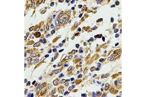 Immunohistochemical analysis of ACAD9 staining in human stomach formalin fixed paraffin embedded tissue section. (ACAD9 anticorps)