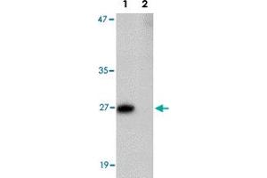 Western blot analysis of PRTFDC1 in human brain tissue lysate with PRTFDC1 polyclonal antibody  at 1 ug/mL in the (Lane 1) absence and (Lane 2) presence of blocking peptide. (PRTFDC1 anticorps  (Internal Region))