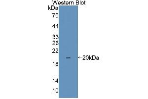 Western blot analysis of the recombinant protein. (IL1F9 anticorps  (AA 5-153))