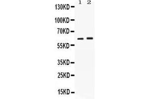 Western blot analysis of SCTR expression in rat kidney extract ( Lane 1) and SKOV3 whole cell lysates ( Lane 2). (SCTR anticorps  (C-Term))