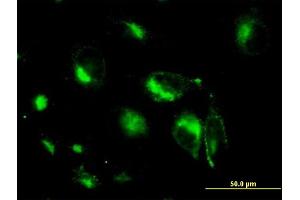Immunofluorescence of monoclonal antibody to STX6 on HeLa cell.