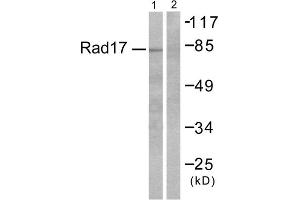 Western blot analysis of extracts from RAW264. (ABHD14A anticorps  (C-Term))
