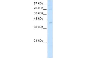 Western Blotting (WB) image for anti-Nuclear RNA Export Factor 5 (NXF5) antibody (ABIN2462318) (NXF5 anticorps)