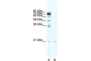 Western Blotting (WB) image for anti-SCAN Domain Containing 1 (SCAND1) antibody (ABIN2461245) (SCAND1 anticorps)