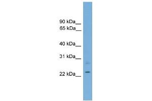 WB Suggested Anti-RBM11 Antibody Titration: 0. (RBM11 anticorps  (Middle Region))