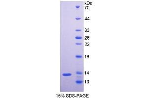 SDS-PAGE (SDS) image for Neurofilament, Light Polypeptide (NEFL) (AA 139-234) protein (His tag) (ABIN1099340)