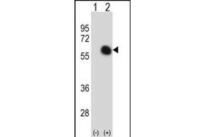 Western blot analysis of GATA2 (arrow) using rabbit polyclonal GATA2 Antibody (C-term) (ABIN390740 and ABIN2841005).