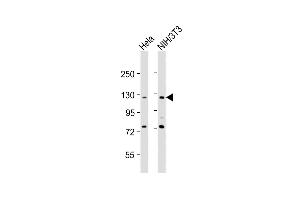 All lanes : Anti-TK Antibody (N-Term) at 1:2000 dilution Lane 1: Hela whole cell lysates Lane 2: NIH/3T3 whole cell lysates Lysates/proteins at 20 μg per lane. (AATK anticorps  (AA 55-90))