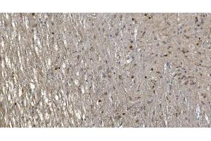 IHC analysis of Alpha B Crystallin/CRYAB using anti-Alpha B Crystallin/CRYAB antibody (ABIN7601209). (CRYAB anticorps  (AA 30-151))