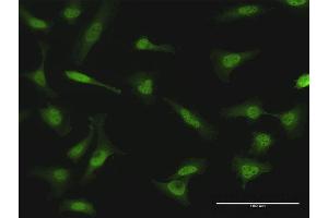 Immunofluorescence of purified MaxPab antibody to NME1 on HeLa cell.