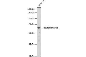 Western blot analysis of extracts of SH-SY5Y cells, using Neurofilament L antibody (ABIN7268867) at 1:10000 dilution. (NEFL anticorps)