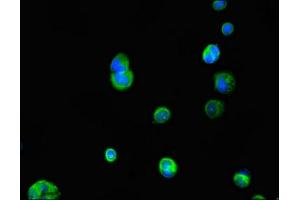 Immunofluorescent analysis of MCF-7 cells using ABIN7156864 at dilution of 1:100 and Alexa Fluor 488-congugated AffiniPure Goat Anti-Rabbit IgG(H+L)