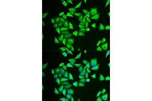 Immunofluorescence analysis of U2OS cells using PGM1 antibody. (Phosphoglucomutase 1 anticorps  (AA 1-300))