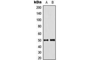 Western blot analysis of Septin 8 expression in HeLa (A), mouse brain (B) whole cell lysates. (Septin 8 anticorps  (Center))