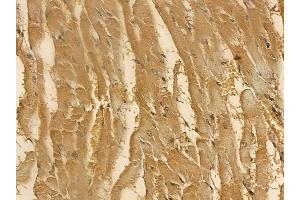 EEF2 Mouse Monoclonal Antibody at 1/100 staining rat heart tissue by IHC-P. (EEF2 anticorps  (Internal Region))