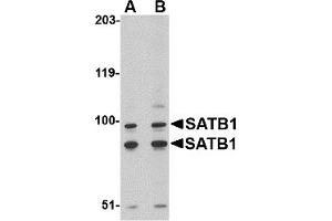 Western Blotting (WB) image for anti-SATB Homeobox 1 (SATB1) (C-Term) antibody (ABIN1030642) (SATB1 anticorps  (C-Term))