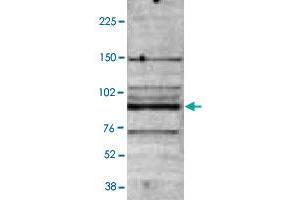 B : Western blot was performed on nuclear extracts from the U-937 (human leukemic monocyte lymphoma cell line ; 40 ug) with MBD4 polyclonal antibody , diluted 1 : 2,000 in TBST containing 3% milk powder. (MBD4 anticorps)