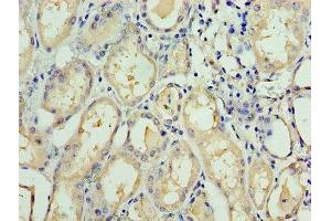 Immunohistochemistry of paraffin-embedded human kidney tissue using ABIN7171562 at dilution of 1:100 (TAF1C anticorps  (AA 70-320))