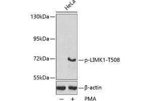Western blot analysis of extracts from HeLa cells, using Phospho-LIMK1-T508 antibody (ABIN3020309, ABIN3020310, ABIN3020311, ABIN1681739 and ABIN7101871).