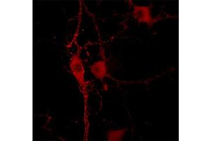 Immunocytochemistry on cultured hippocampus neurons (dilution 1 : 500). (PACSIN1 anticorps  (AA 293-384))