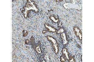 IHC analysis of RAB1B using anti-RAB1B antibody (ABIN7602809). (RAB1B anticorps  (C-Term))