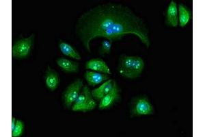 Immunofluorescent analysis of MCF-7 cells using ABIN7154424 at dilution of 1:100 and Alexa Fluor 488-congugated AffiniPure Goat Anti-Rabbit IgG(H+L)