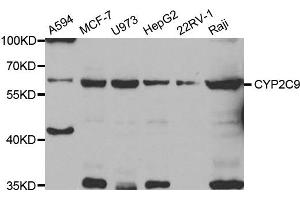 Western Blotting (WB) image for anti-Cytochrome P450, Family 2, Subfamily C, Polypeptide 9 (CYP2C9) antibody (ABIN1882346) (CYP2C9 anticorps)