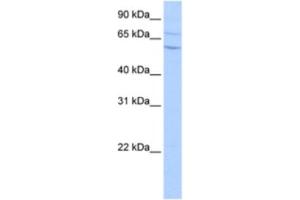 Western Blotting (WB) image for anti-Carboxypeptidase N Subunit 2 (CPN2) antibody (ABIN2463477)