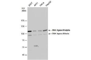WB Image DNA ligase III antibody detects DNA ligase III protein by western blot analysis. (LIG3 anticorps)