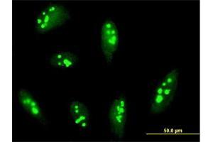 Immunofluorescence of purified MaxPab antibody to RRP12 on HeLa cell. (RRP12 anticorps  (AA 1-1297))