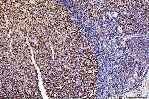 IHC analysis of FEN1 using anti-FEN1 antibody (ABIN7601618). (FEN1 anticorps  (AA 4-300))