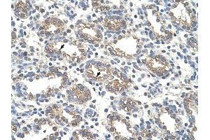 Arginase 1 antibody was used for immunohistochemistry at a concentration of 4-8 ug/ml to stain Alveolar cells (arrows) in Human Lung. (Liver Arginase anticorps  (Arg1, N-Term))