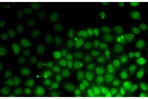 Immunofluorescence analysis of HeLa cells using HMGN2 Polyclonal Antibody (HMGN2 anticorps)