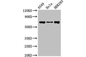 Western Blot Positive WB detected in: A549 whole cell lysate, Hela whole cell lysate, HEK293 whole cell lysate All lanes: CRTC1 antibody at 3. (CRTC1 anticorps  (AA 1-248))