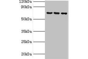 Western blot All lanes: ABCF2 antibody at 4 μg/mL Lane 1: 293T whole cell lysate Lane 2: Hela whole cell lysate Lane 3: NIH/3T3 whole cell lysate Secondary Goat polyclonal to rabbit IgG at 1/10000 dilution Predicted band size: 72, 73 kDa Observed band size: 72 kDa