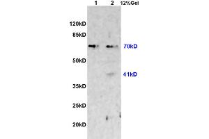 L1 rat heart lysates L2 rat brain lysates probed with Anti CX3CL1 Polyclonal Antibody, Unconjugated (ABIN728488) at 1:200 overnight at 4 °C. (CX3CL1 anticorps  (AA 301-397))