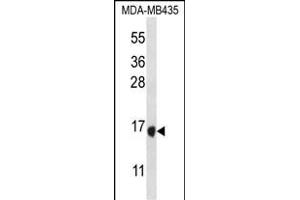 TAC4 Antibody (C-term) (ABIN656772 and ABIN2845991) western blot analysis in MDA-M cell line lysates (35 μg/lane). (Tachykinin 4 anticorps  (C-Term))