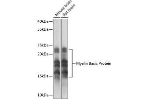 Western blot analysis of extracts of various cell lines, using Myelin Basic Protein Rabbit mAb (ABIN7268431) at 1:1000 dilution. (MBP anticorps)